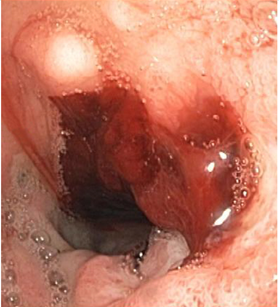 ddb98180199e3939ac527950f6ce0b1a