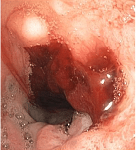 ddb98180199e3939ac527950f6ce0b1a